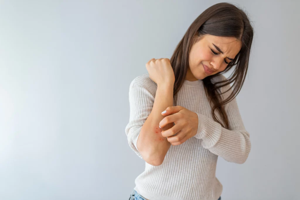 Teenager Girl Struggling With Psoriasis Treatment in Houston, TX | Vida Aesthetics And Wellness