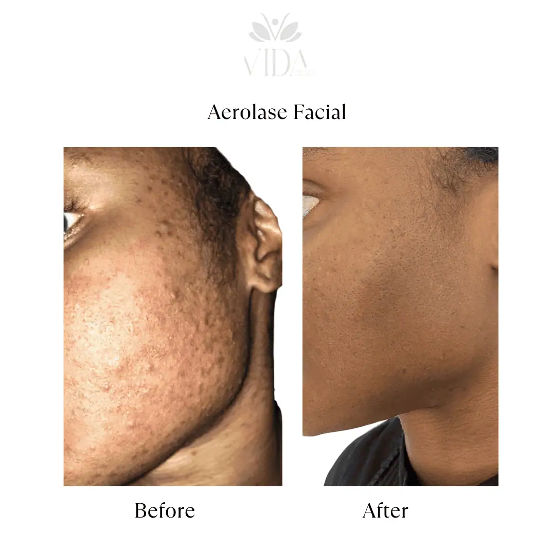 Facial Services-Before-After (3)