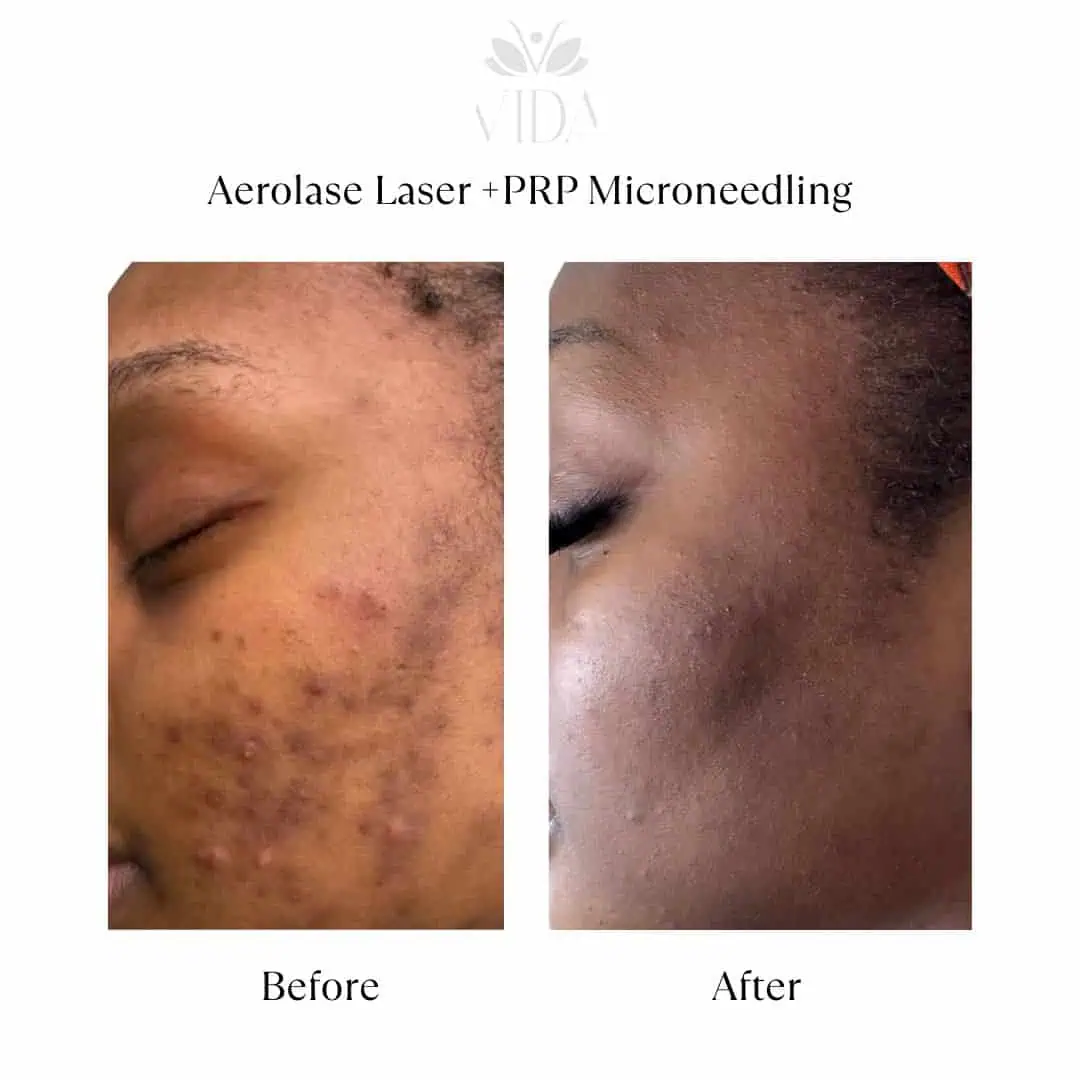 Facial Services-Before-After (4)