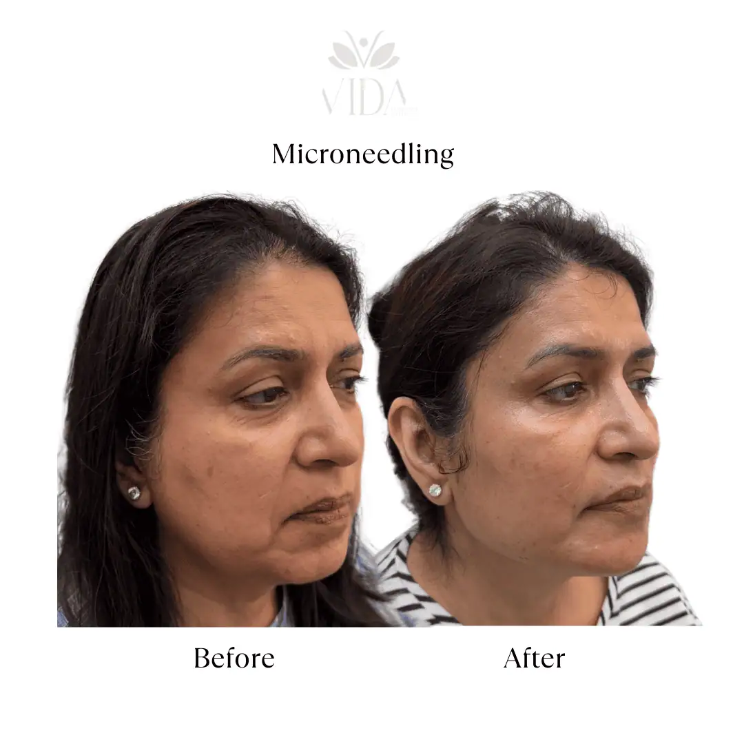 Facial Services-Before-After (5)