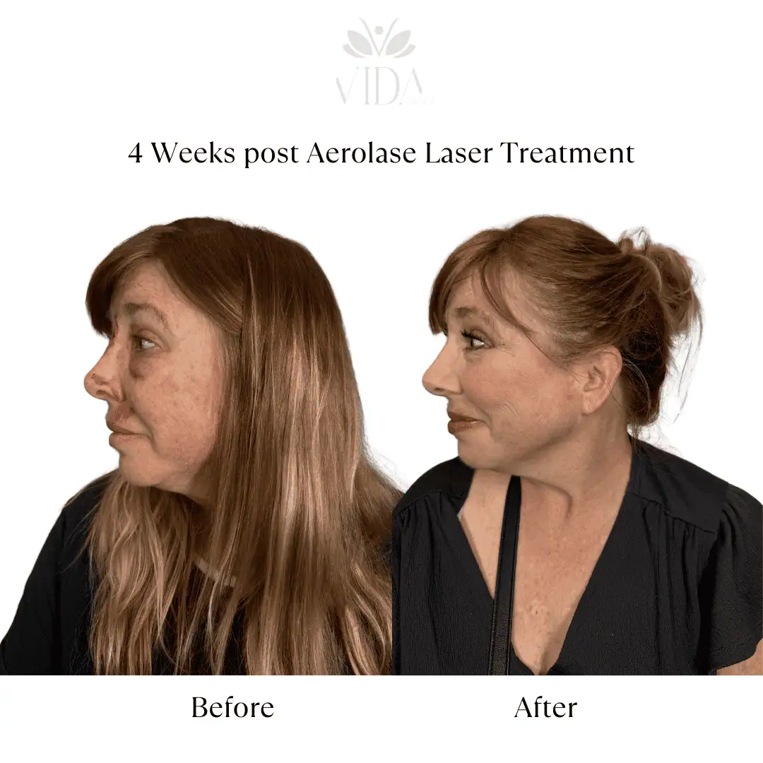 Facial Services-Before-After (6)