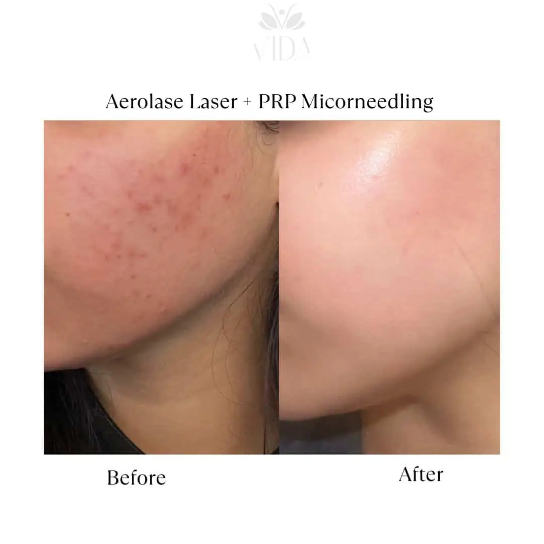 Facial Services-Before-After