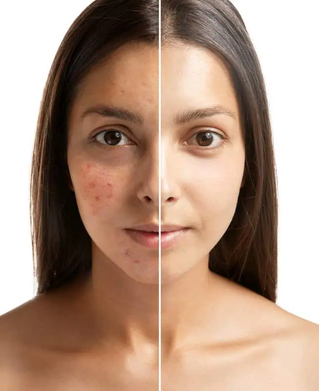 Melasma and Hyperpigmentation by Integrative Wellness Group LLC in Houston , TX