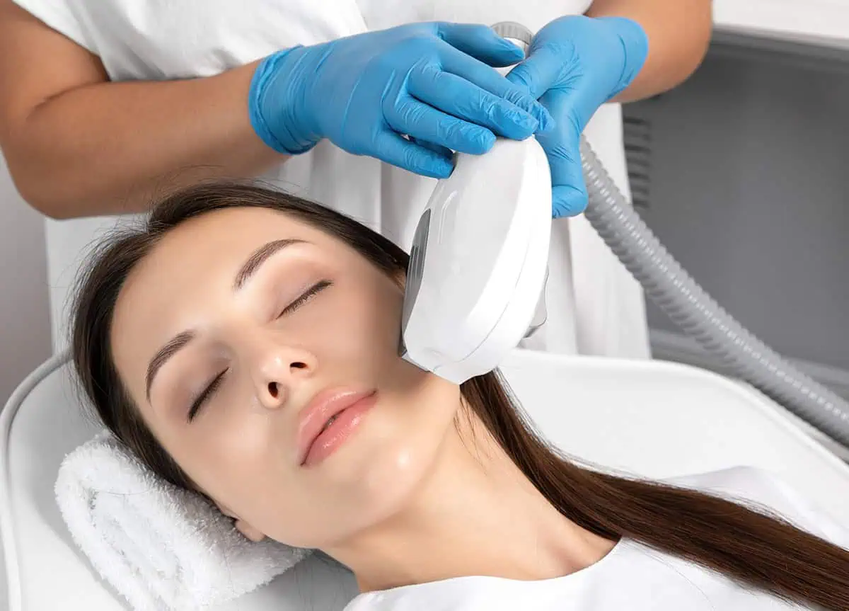 Laser Hair Removal for Facial Hair