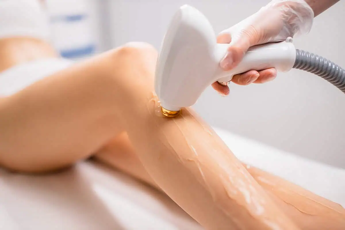 Laser Hair Removal for Legs