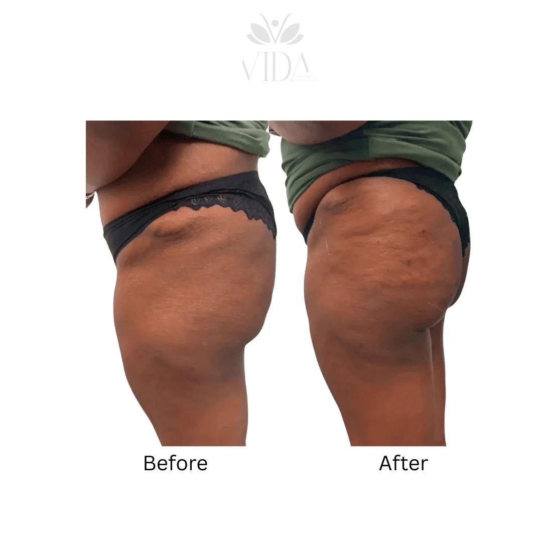 Liquid BBL Before And After