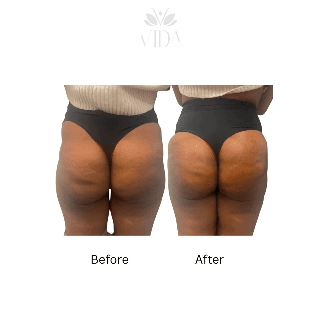 Liquid BBL Before And After