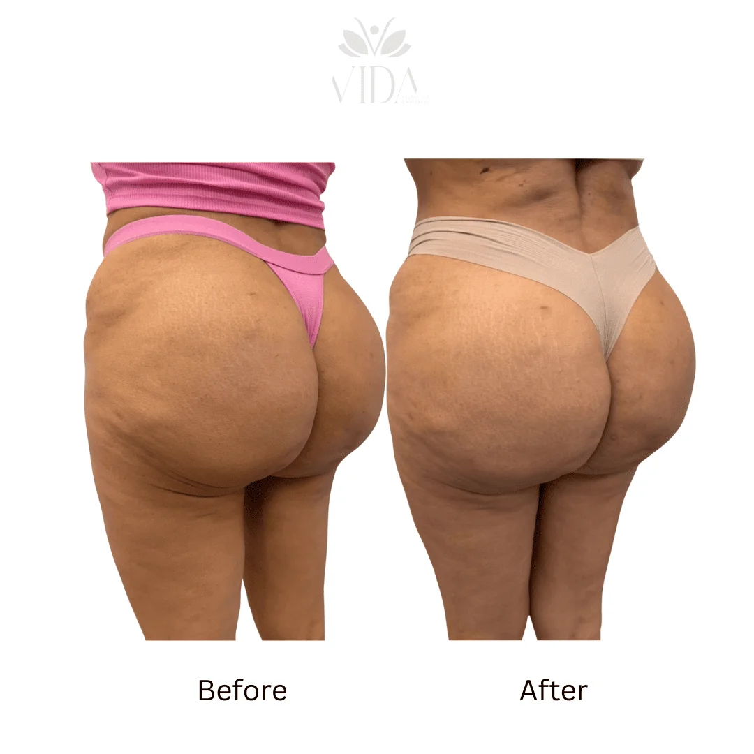 Liquid BBL Before And After