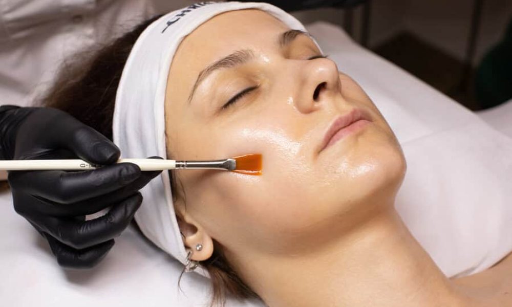 BioRePeel by Vida Aesthetics And Wellness in Houston, TX